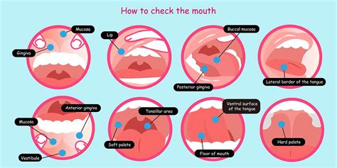 Oral Cancer Screening For Mouth Cancer At Parkhill Dental Practice