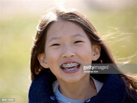 Asian Girl Braces Stock Fotos Und Bilder Getty Images