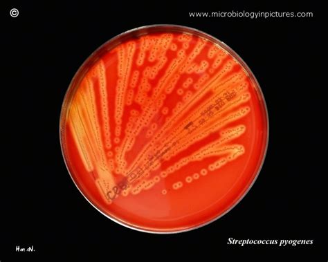 Blood Agar Plate With Beta Hemolytic Colonies Of Streptococcus Pyogenes