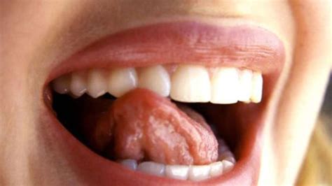 Aphten medikamentös zu behandeln ist meist nur dann nötig, wenn die blasen im mund in regelmäßigen abständen immer wiederkehren oder besonders zahlreich auftreten. Aphten können auf Vitamin-Mangel hinweisen | Gesundheit