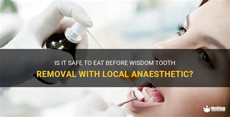 Is It Safe To Eat Before Wisdom Tooth Removal With Local Anaesthetic