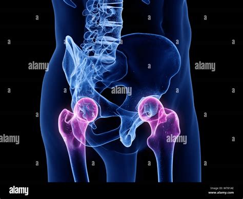 3d Rendered Medically Accurate Illustration Of The Hip Joints Stock