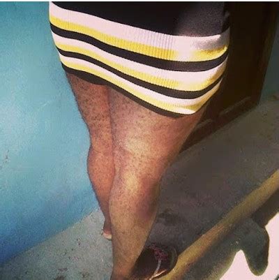 Nigerias Hairiest Woman Queen Okafor Shows Off Her Hot Legs