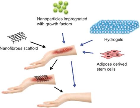Various Nanotechnology Based Methods For Skin Regeneration Download