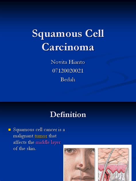 An Overview Of Squamous Cell Carcinoma Causes Symptoms Treatment