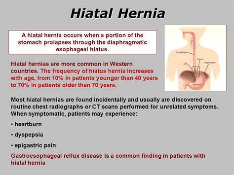 Can A Hiatal Hernia Cause Bloating Symptoms Causes Self Care And