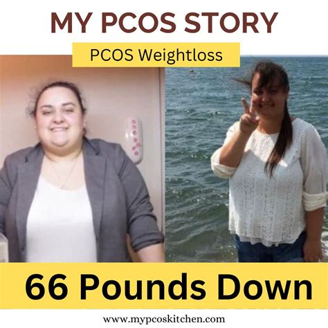 Pcos Before And After