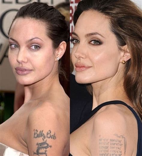 Angelina Jolie Plastic Surgery Tweaks To Improve Her Beauty