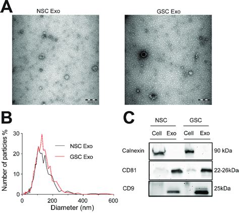Characterization Of Exosomes Isolated From Neural And Brain Tumor Stem