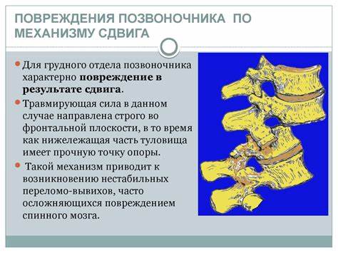 Компрессионный перелом позвоночника диета Переломы позвоночника презентация травматология - 82 фото Переломы позвоночника презентация травматология - 82 фото Компрессионный перелом позвоночника диета