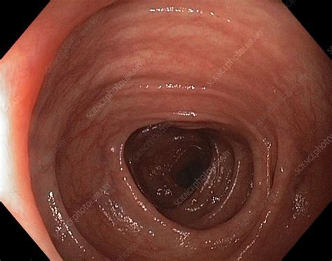 Colon (punctuation) (:), a punctuation mark. Healthy colon (large intestine) - Stock Image - C009/6168 - Science Photo Library