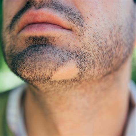 How To Fix A Patchy Beard And Grow Thicker Hair