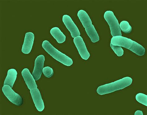 Lactobacillus Sp Rod Prokaryote Photograph By Dennis Kunkel