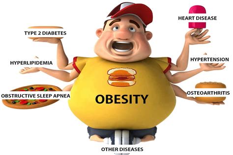 Obesity Causes Symptoms And Treatment Famhealth