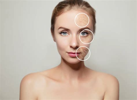 2300 Irritated Skin Mask Stock Photos Pictures And Royalty Free Images