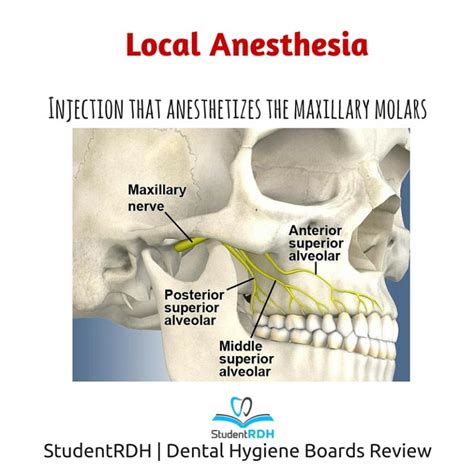Which Injection Anesthetizes The Maxillary Posterior Teeth