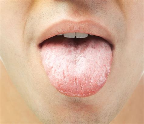 Ce spune limba despre starea ta de sănătate