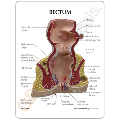 Rectum Model Gpi Anatomicals