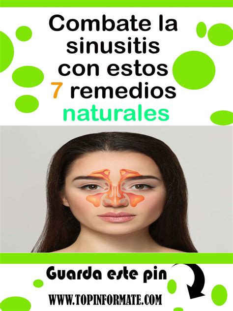 Combate La Sinusitis Con Estos 7 Remedios Naturales Remedios