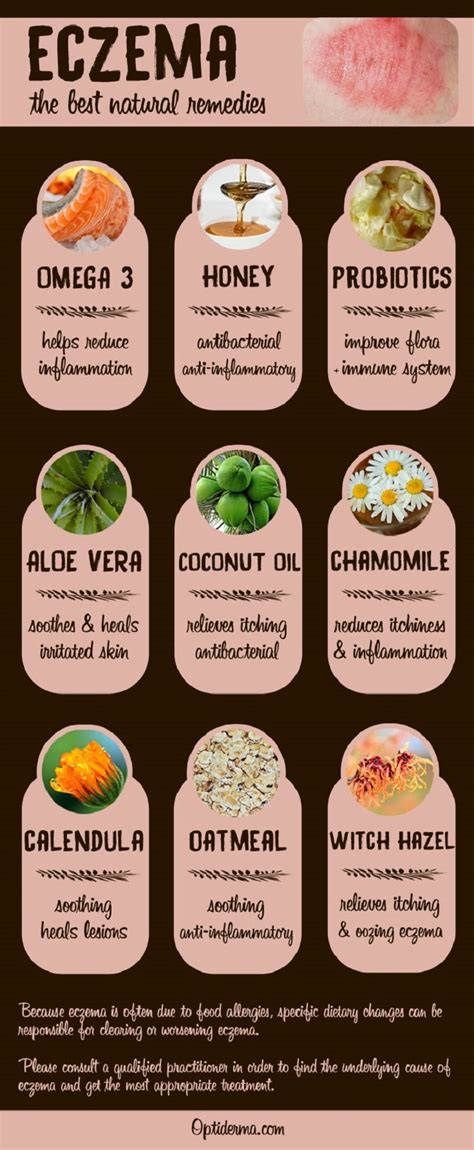 Learn what medical treatments can help a significant part of eczema treatment is caring for the skin at home and avoiding allergens and triggers. 15 Best Natural Eczema Remedies, Treatments, Tips and Tricks