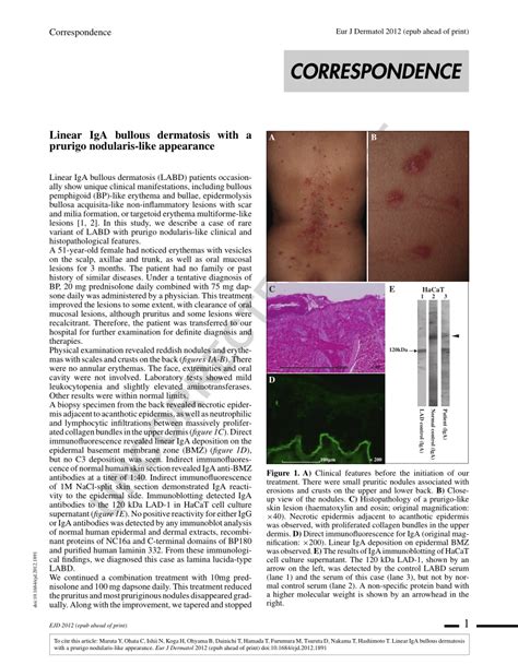 Pdf Linear Iga Bullous Dermatosis With A Prurigo Nodularis Like