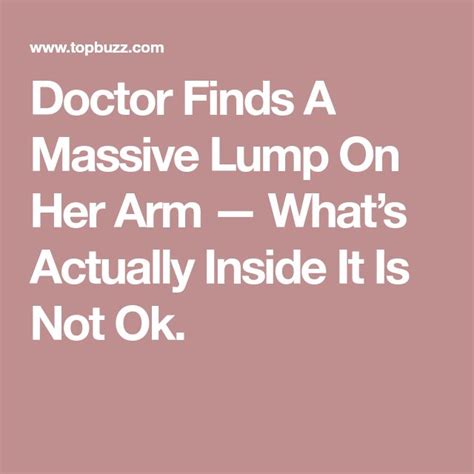 Doctor Finds A Massive Lump On Her Arm — Whats Actually Inside It Is
