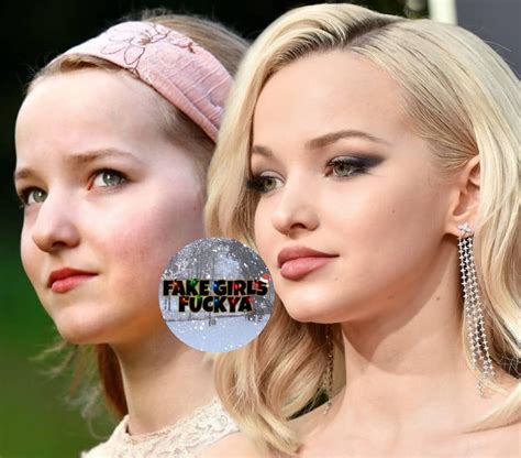 Dovecameron Before And After Dovecameron Antes Y Despu S