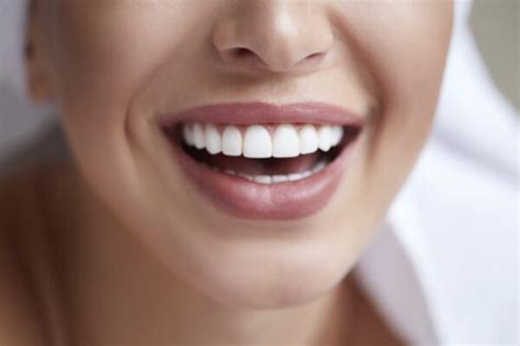 Veneers For Narrow Smiles How To Widen Your Smile