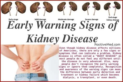 Early Warning Signs Of Kidney Disease 20140730