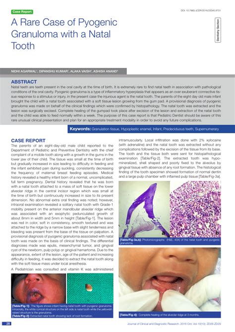 Pdf A Rare Case Of Pyogenic Granuloma With A Natal Tooth
