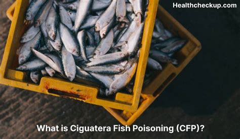 Ciguatera Fish Poisoning Symptoms Diagnosis Treatment Health Checkup