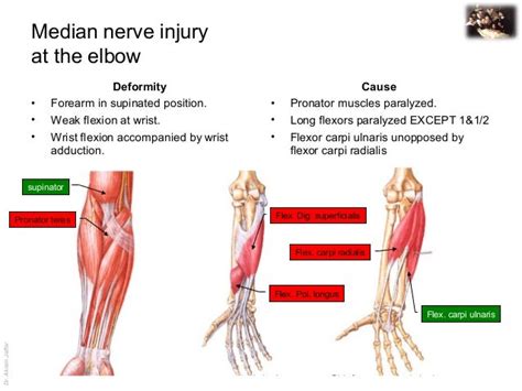 Median Nerve Anatomy Elbow
