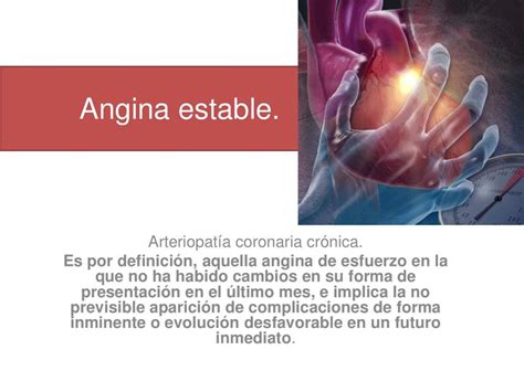 Angina Estable Cynthia MC UDocz