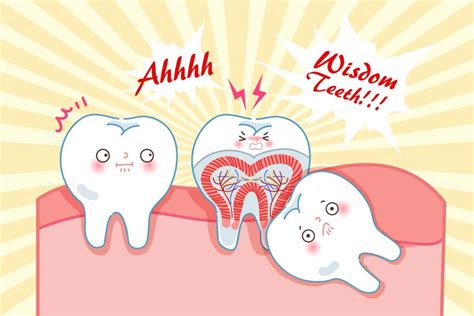 Can Wisdom Teeth Cause Headaches Bright Smile Dental Powell