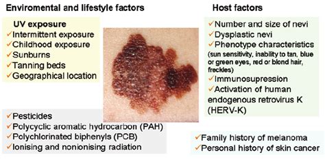risk factors for cutaneous melanoma download scientific diagram