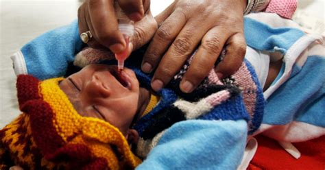 Poliomyelitis 24 Photos Of Crippling Disease Photo 1 Pictures