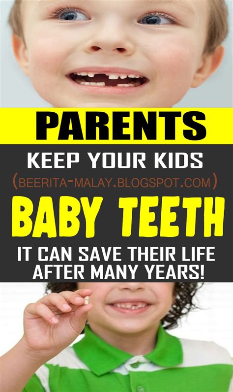Doctors Urge Parents Keep Your Kids Baby Teeth Beauty Tips