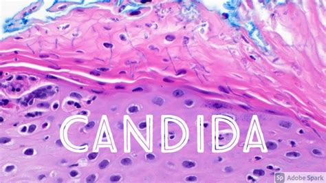 Candida Yeast Infection Under Microscope Candidiasis Dermatology