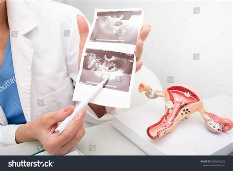 Closeup Ultrasound Ovaries Female Health Examination Stock Photo