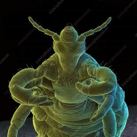 Coloured Sem Of A Human Body Louse Pediculus Stock Image Z