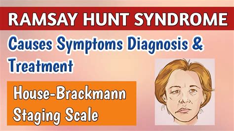 Ramsay Hunt Syndrome Symptoms And Care Varicella Herpes Zoster Oticus