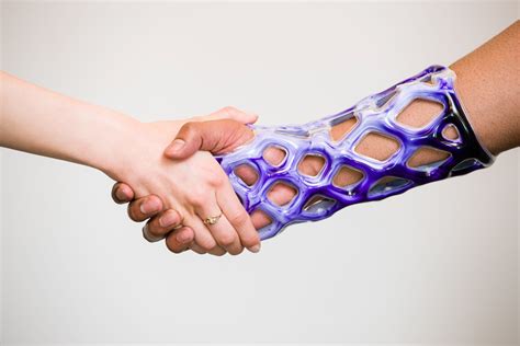 Cast 21 Mesh Sleeve That Can Replace Traditional Casts — Elevated Health