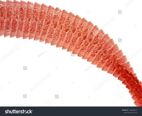 1 Tapeworm Lifecycle Images Stock Photos And Vectors Shutterstock