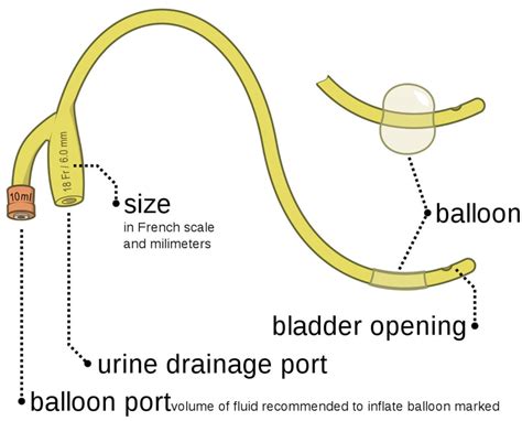 Urinary Catheter Types Of Urinary Catheter And Urinary Catheter Complications