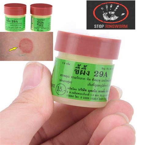 Ringworm Treatment Herbal And Natural Ointment Zambia Ubuy