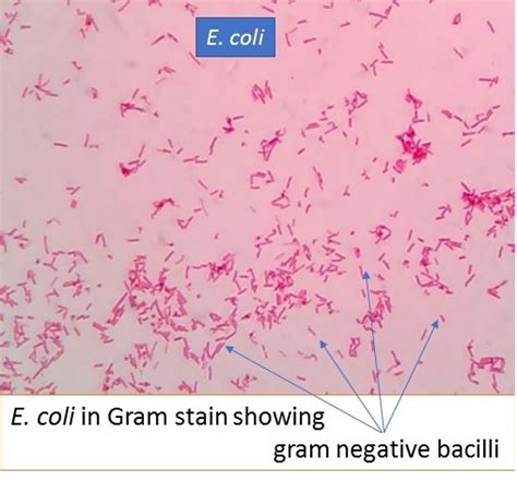 E Coli In Gram Stain Introduction Pathogenic Strains And Lab Diagnosis