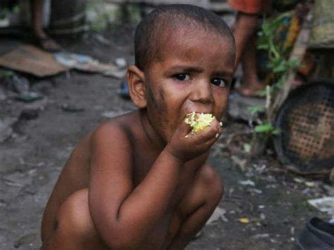 Malnutrition Rates Soar Among Rohingya Children In Bangladesh Un