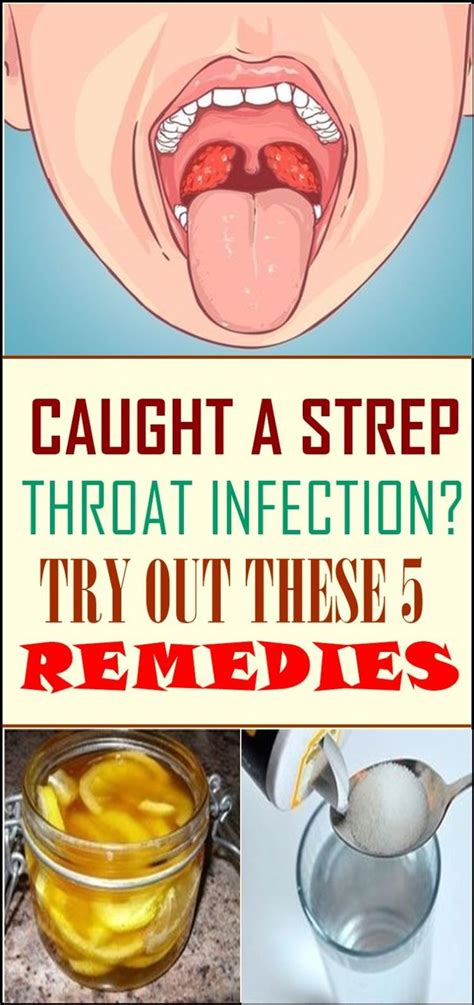 Caught A Strep Throat Infection Try Out These 5 Natural Diy Remedies