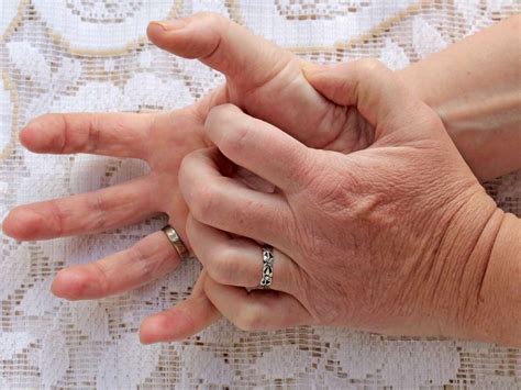 Itchy Fingers Symptoms Causes And Treatment My Best Medicine