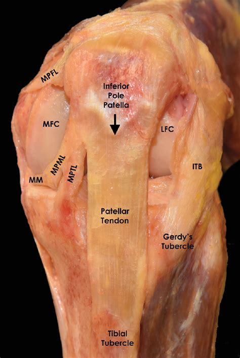 Patellar Tendon Anatomy Muscle